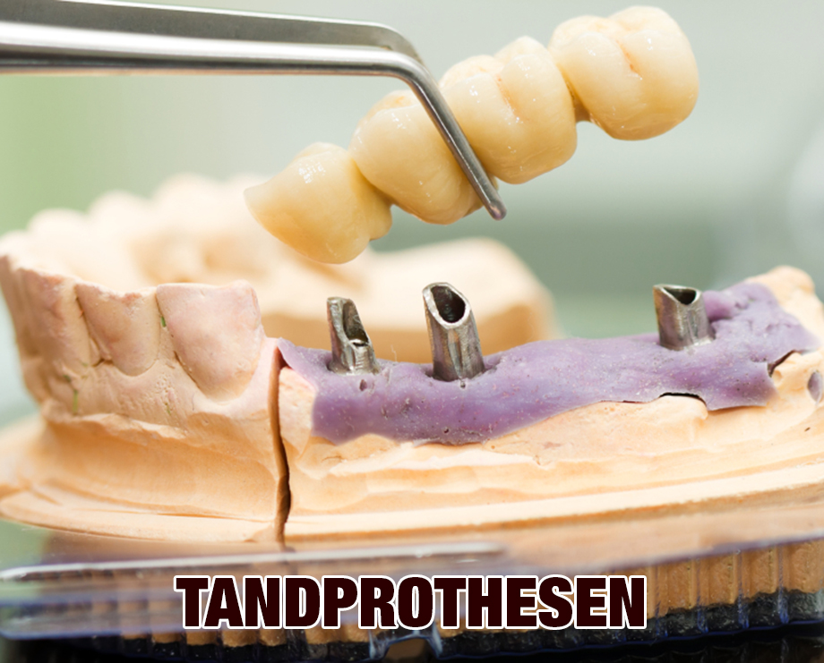 tandprothesen-NL