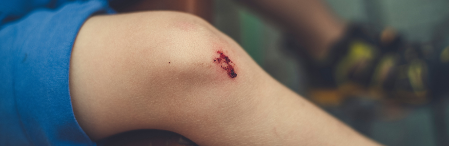 Schoolongeval met eventueel aansprakelijkheid